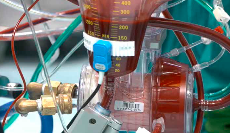 Optimally designing an artificial lung for extracorporeal life support