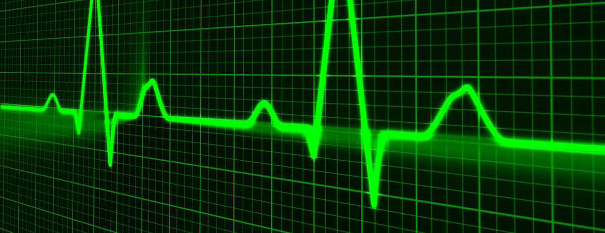 <p>Numerical simulation of the hemodynamics of the HeartAssist 5® Ventricular Assist Device</p>